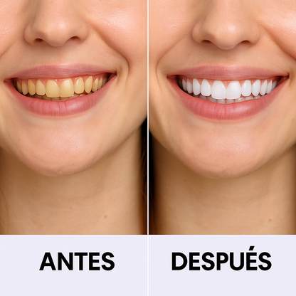 Tiras Blanqueadoras Lumissy™ V34 + PAP+